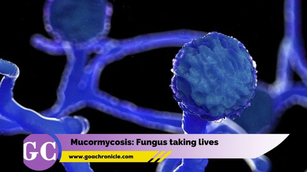 Mucormycosis: Fungus taking lives