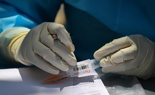 China’s coronavirus found in the US as early as Mid-December 2019: NIH Study