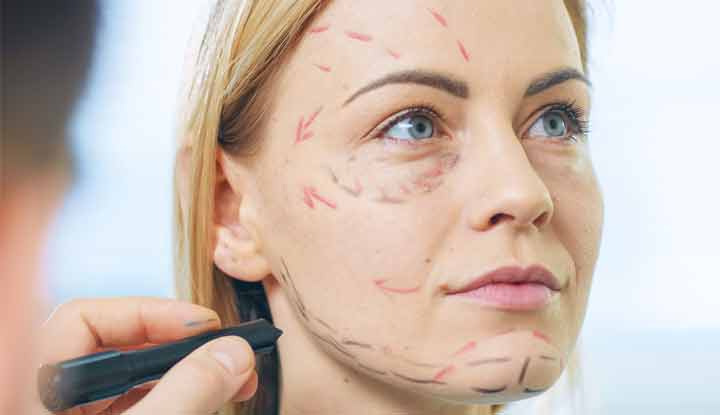 People in USA undergoing surgery to remove face fat, risk of face paralysis increases