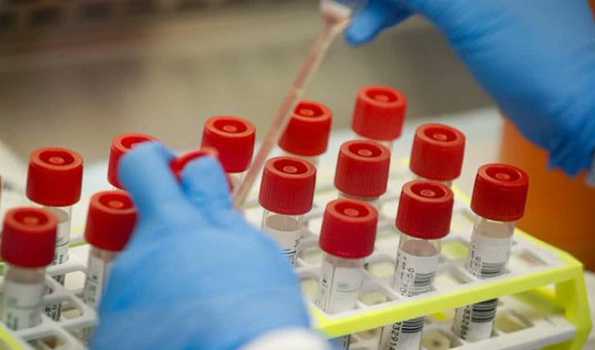 India records 1,021 Covid cases in last 24 hour