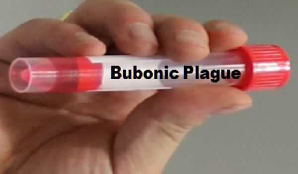 Three suspected cases test negative for bubonic plague in Mongolia